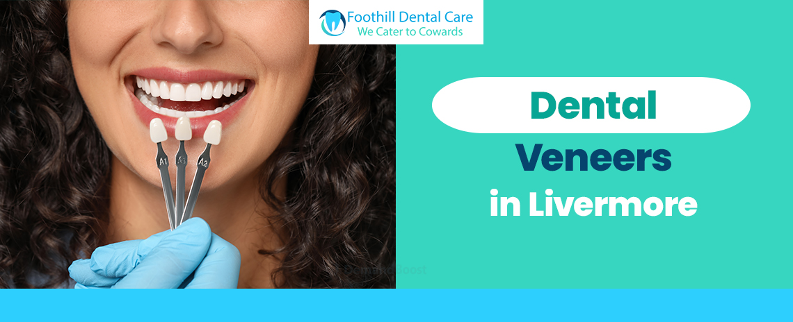 Dental Veneers in Livermore