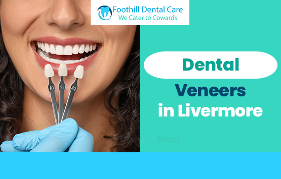 Dental Veneers in Livermore