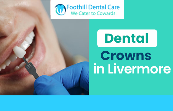 Dental Crowns in Livermore