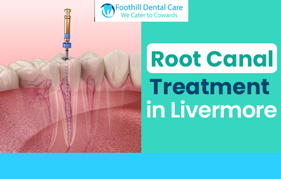 Root Canal Treatment at Foothill Dental Care