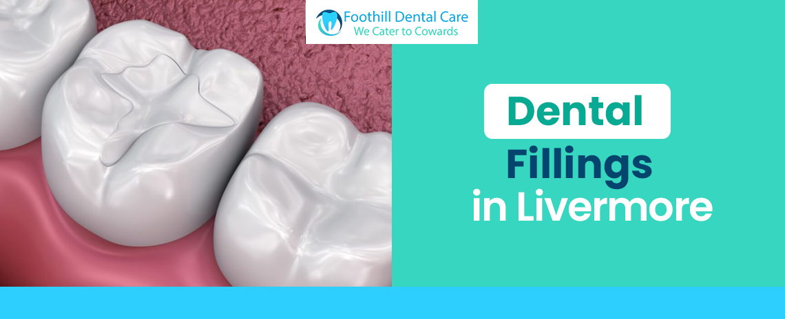 Dental Fillings in Livermore